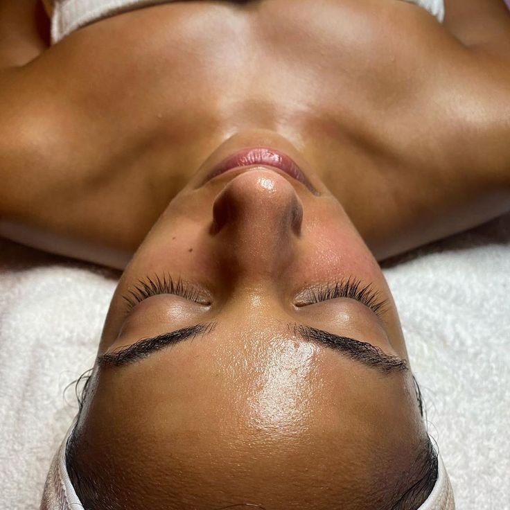 Carboxi Terapia Facial | Depósito $25 | Precio $80