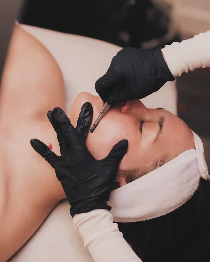 Dermaplaning | Depósito $25 | Precio $85