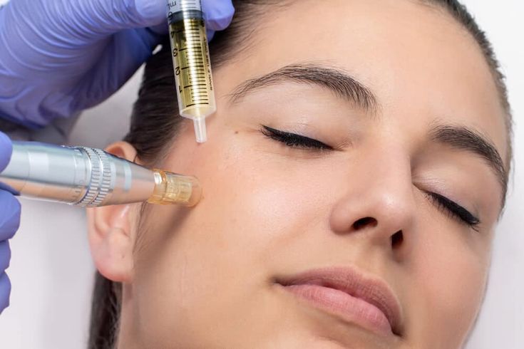 Facial Plasma Rico en Plaquetas | Depósito $100 | Precio $290