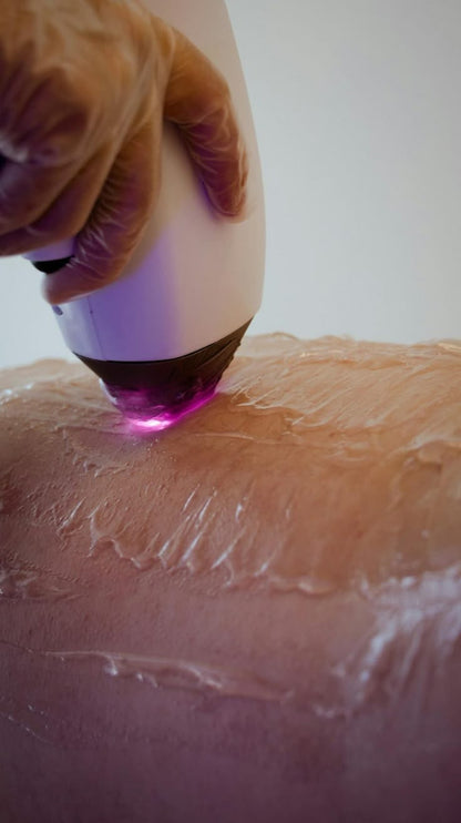 Laser Damas | Sesión Individual | Depósito $25